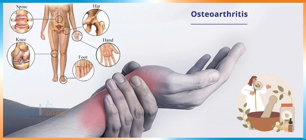 Homoeopathic Management in Osteoarthritis